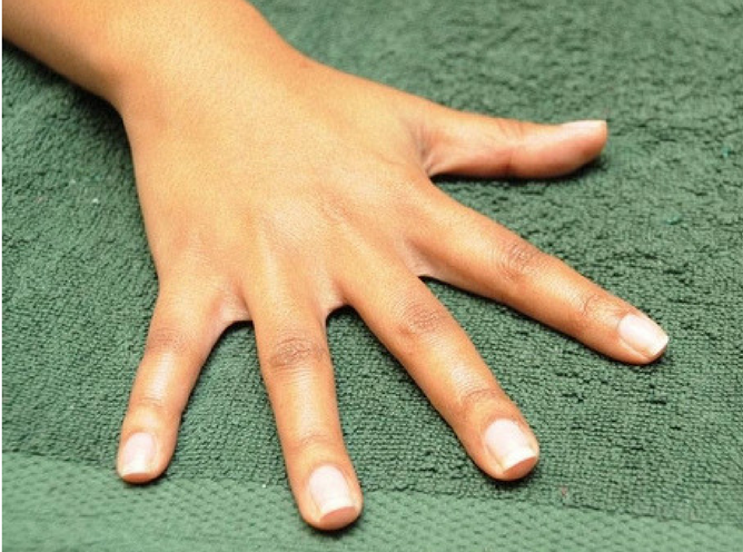 Have Fingernails Me Too